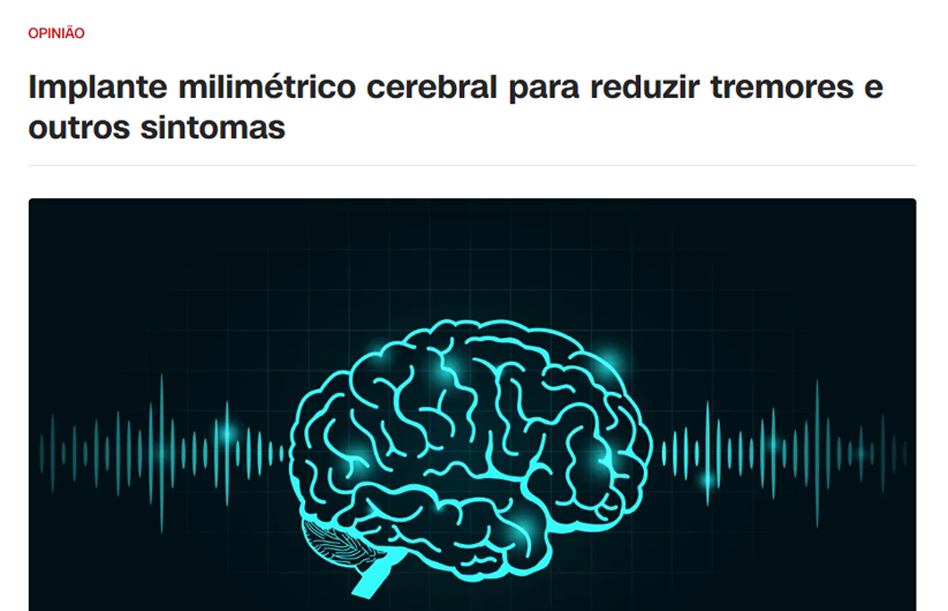 https://www.cnnbrasil.com.br/forum-opiniao/implante-milimetrico-cerebral-para-reduzir-tremores-e-outros-sintomas/